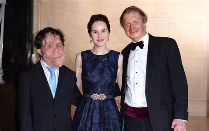 Adam Pearson's Wife: A Comprehensive Insight into Their Relationship