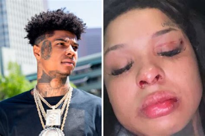 Blueface Reacts After Chrisean Rock Considers An Abortion: "Do It Please"