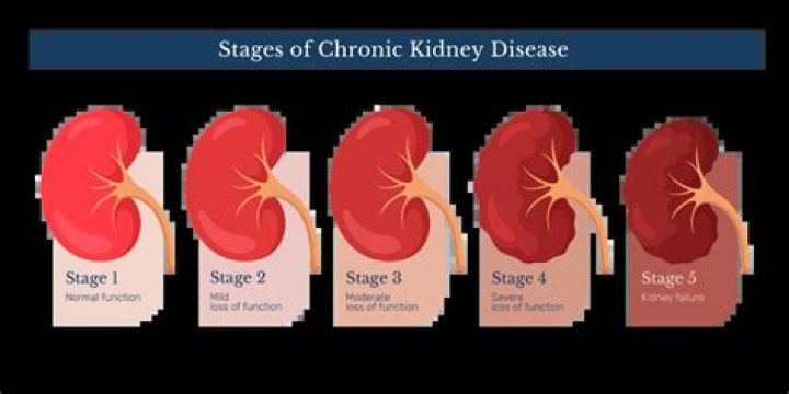 Chika Divulges On Kidney Failure Hospitalization