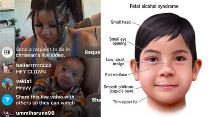 Chrisean Rock & Blueface's Son Whines In New Clip, Fetal Alcohol Syndrome Allegations Continue