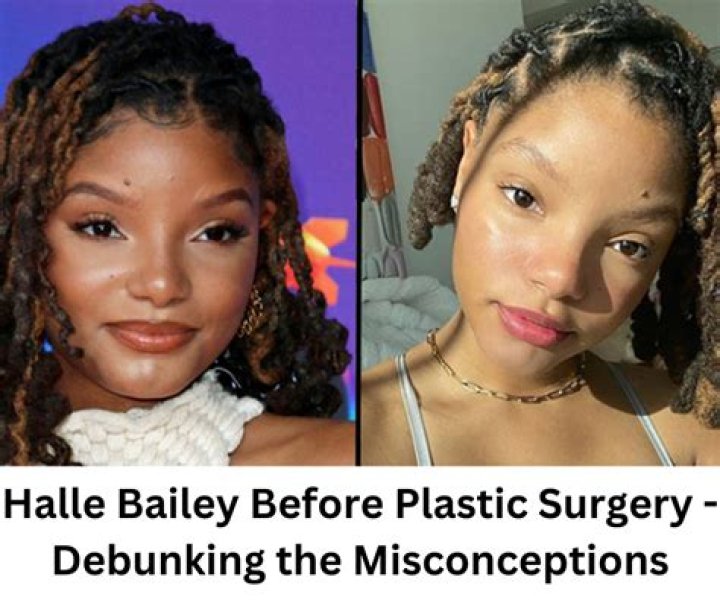 Did Singer Halle Bailey Get Plastic Surgery? The ‘Little Mermaid’ Star Weighs In