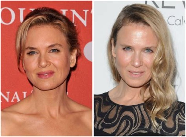 Did Uma Thurman Get Plastic Surgery? The Actress’ Face Looks Completely Different From the Last Time We Saw Her