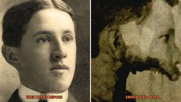 Eben Byers, The Man Who Drank Radium Until His Jaw Fell Off