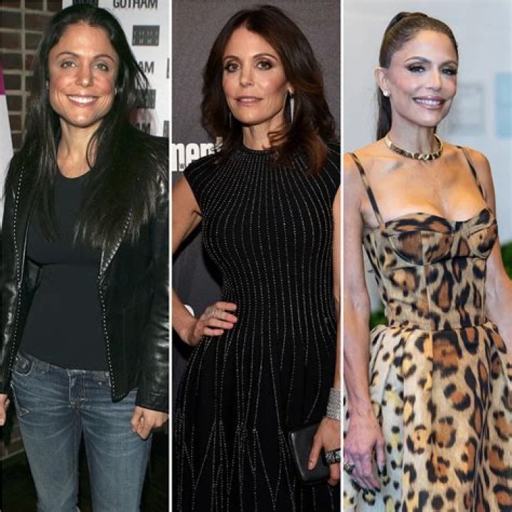 Has Bethenny Frankel Had Plastic Surgery? The Former ‘RHONY’ Star Details Past Procedures