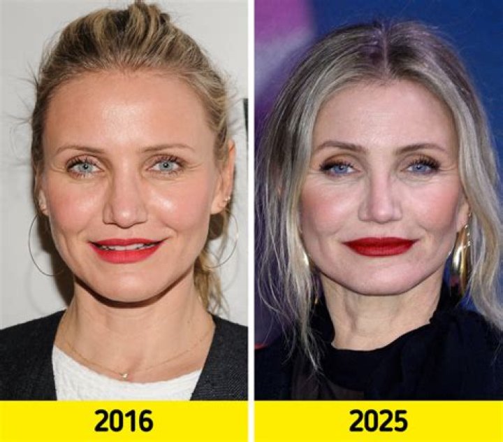 Has Cameron Diaz Had Plastic Surgery? Her Transformation From Rom-Com Darling Through Today