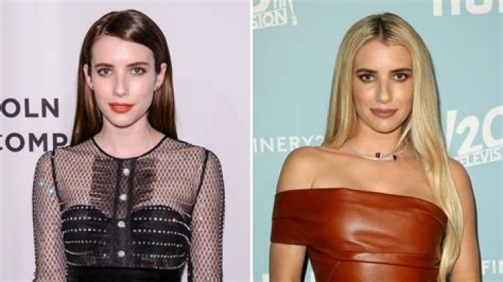 Has Emma Roberts Had Plastic Surgery? See Transformation Photos of the ‘American Horror Story’ Star