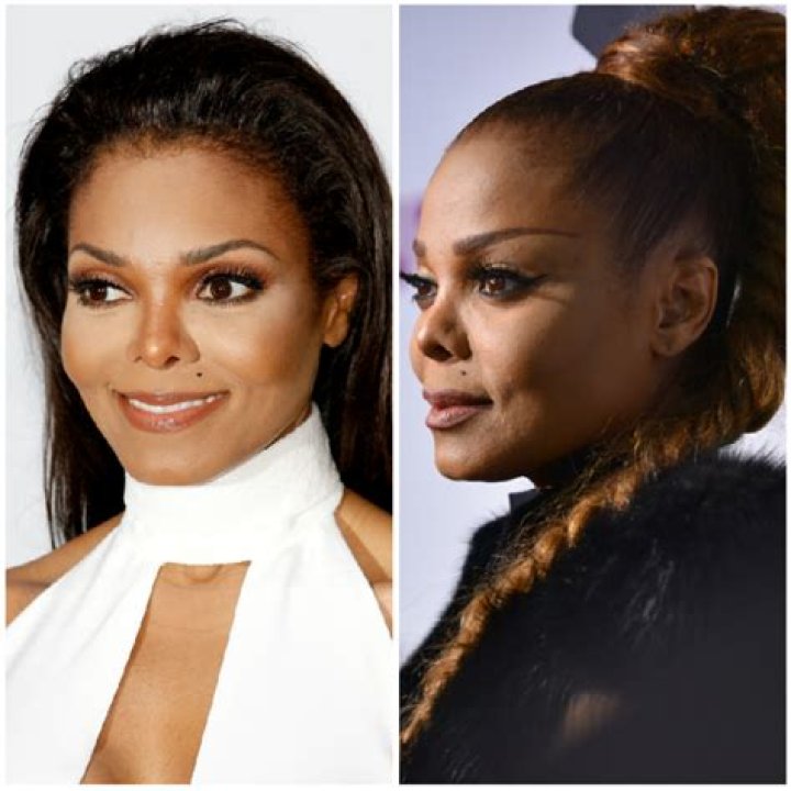 Janet Jackson’s Nose Reportedly Collapsing Amid World Tour