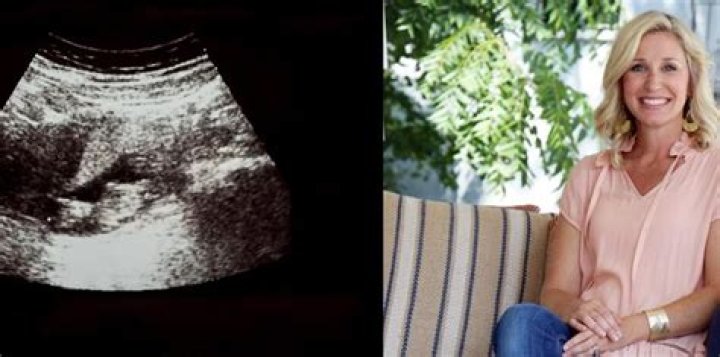 Jenny Marrs Reveals Pregnancy News Following Unexpected Ultrasound