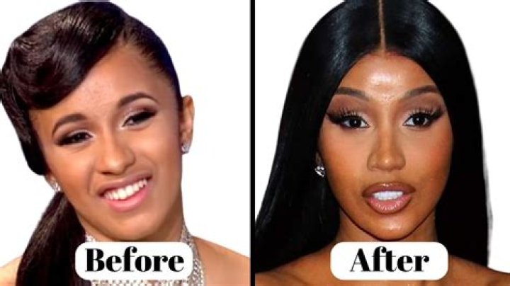 Kash Doll Admits To Having Gotten Plastic Surgery: "I'm Not Ashamed"