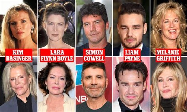 Kylie Jenner’s Doctor Praises Her “Amazing Metamorphosis” — See How Much Her Face Has Changed!