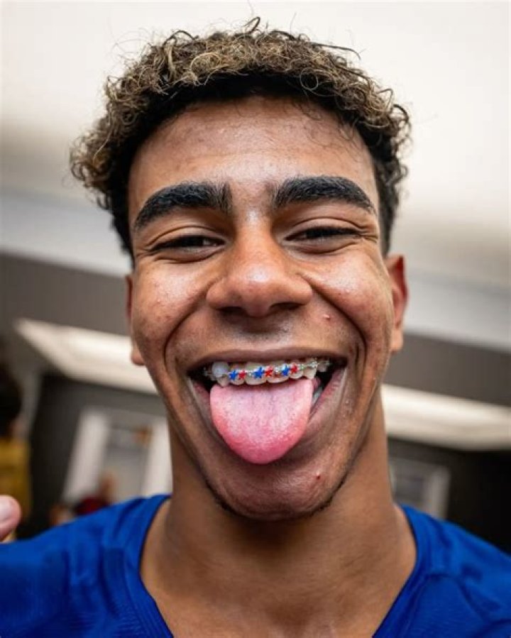 Lil Pump Gets His Braces Taken Off After Six Years