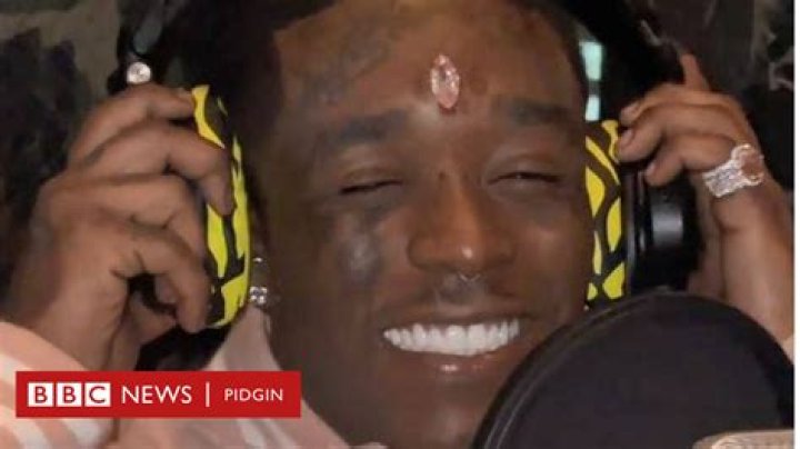 Lil Uzi Vert Gives Close Look At His $24 Million Diamond Forehead Implant