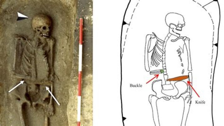 Medieval Italian Warrior Used A Bladed Weapon To Replace His Amputated Hand