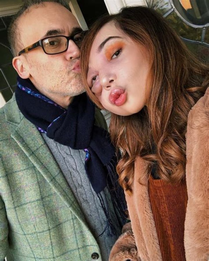 Nikki Lilly Biography | Age, Wiki, Parents, Bio, Height, Health Condition|