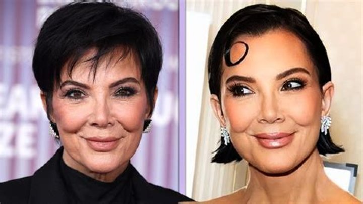 Plastic Surgeon Says Kris Jenner’s Sunglasses May Be Totally ‘Routine’ If She Recently Had Work Done