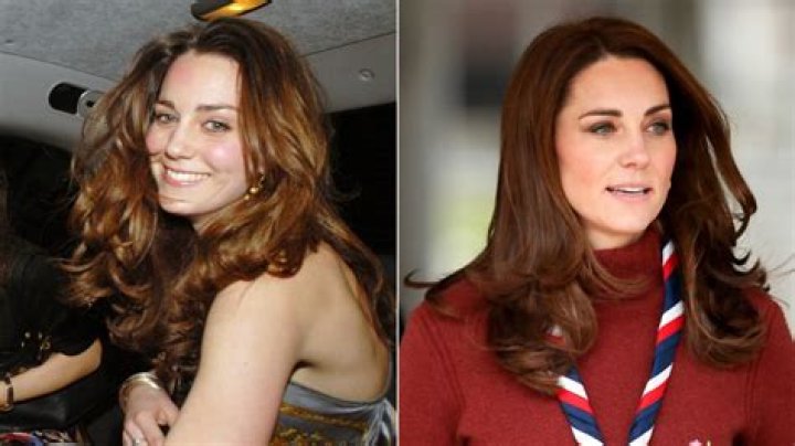 Plastic Surgery Expert Thinks It’s ‘Impossible’ for Kate Middleton to Not Have Used Botox, Despite Palace Claims