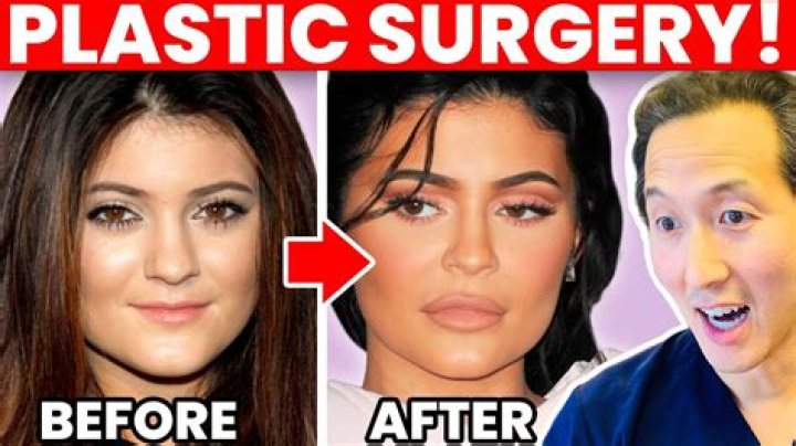 Plastic Surgery or Photoshop? Kylie Jenner Accused of Altering Her Butt in New Instagram Pic