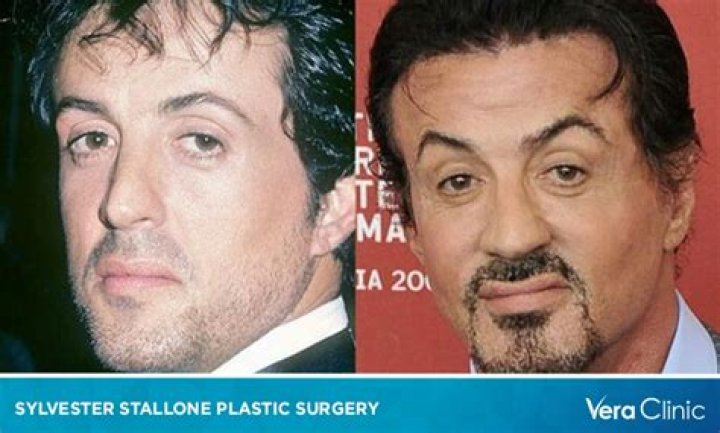 Plastic Surgery?See Jackie Stallone’s Shocking Transformation Right Before Your Eyes
