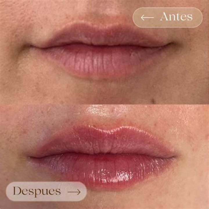 ¿Puedes sentir los rellenos de labios al besar? – Celebrity.fm