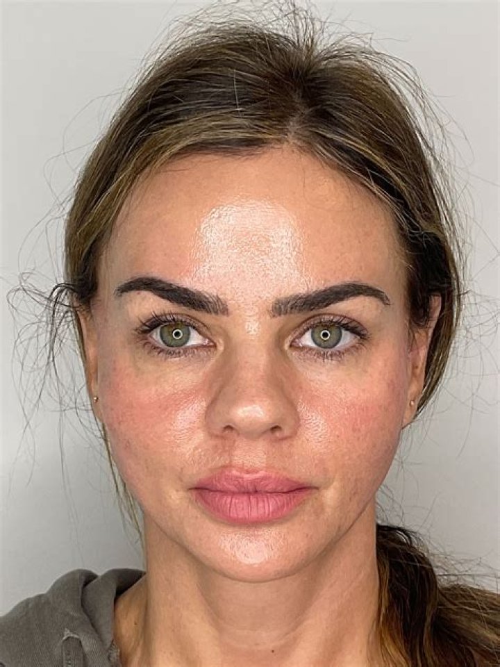 ‘RHOD’ Star Cary Deuber Shares Her Plastic Surgery Secrets: ‘I Do My Own Botox!’ (EXCLUSIVE)