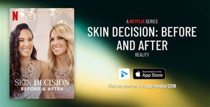 ‘Skin Decision: Before and After’ on Netflix Is ‘Inspiring and Uplifting,’ Says Star Nurse Jamie