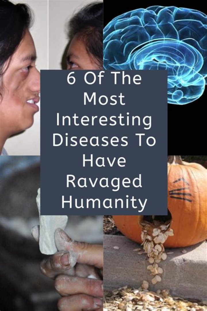 The Most Interesting Diseases To Have Ravaged Humanity