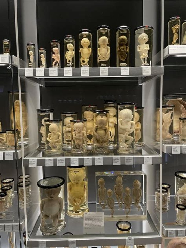 The Mütter Museum's 25 Most Curious And Grotesque Medical Oddities