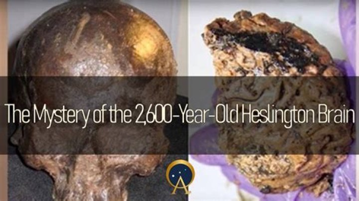 The Mystery Of The 2,600-Year-Old 'Heslington Brain'
