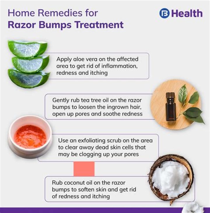 Treat and Prevent Pesky Razor Burn With These Expert Tips