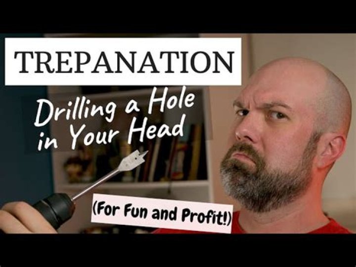 Trepanation Was The Bizarre Cure-All That Exposed Your Brain