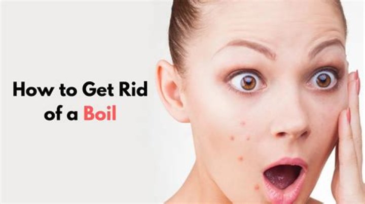 What ingredients are in cure for boils? – Celebrity.fm – #1 Official Stars, Business & People Network, Wiki, Success story, Biography & Quotes