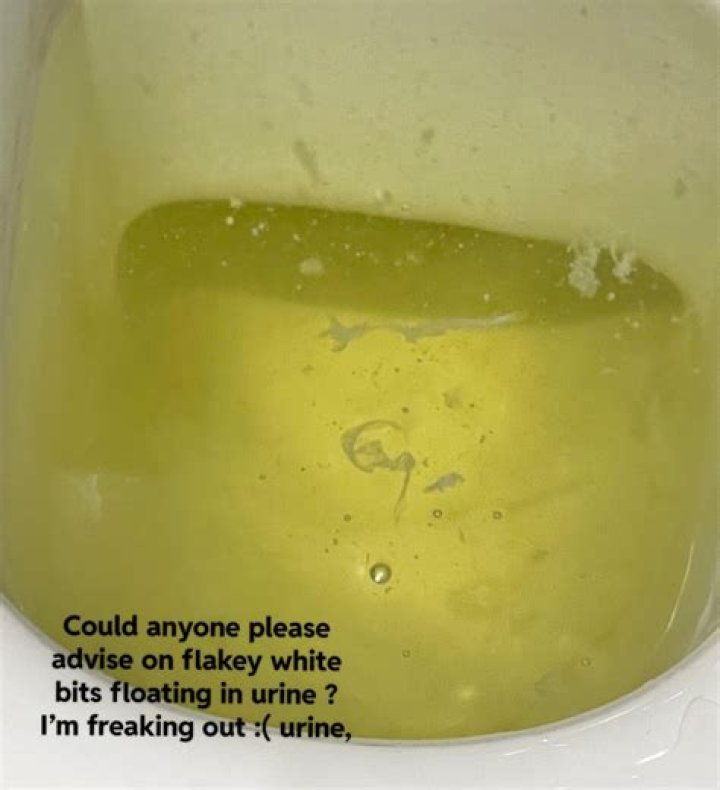 Why do I have white stringy stuff in my urine?