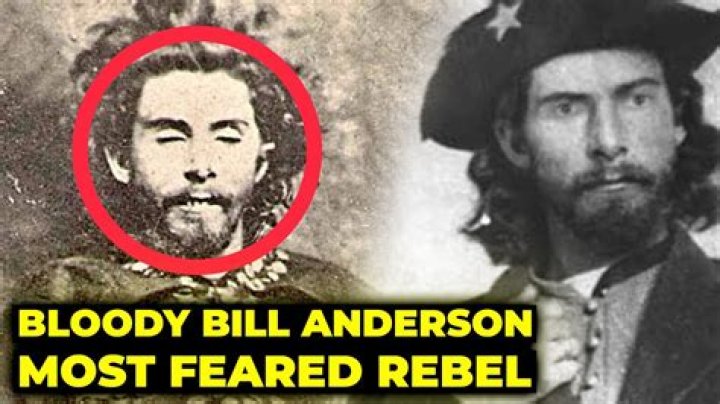 William "Bloody Bill" Anderson, The Brutal Confederate Guerrilla Leader