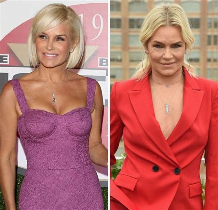 Yolanda Hadid Showcases Her New Body Without ‘Breast Implants, Fillers, Botox, And All The Bulls—t’